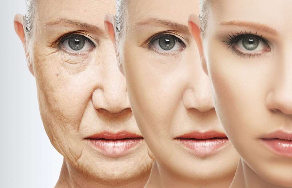 Anti-Wrinkle Injection