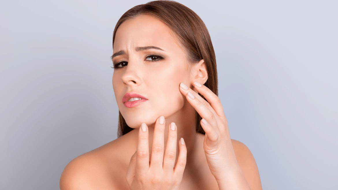 Keep Acne at Bay with Tips from Dermatologist