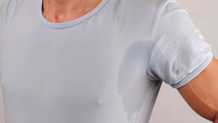 Excessive sweating and Botulinum Toxin